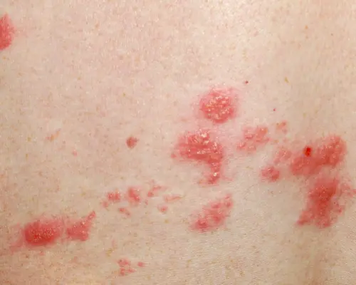 Depositphotos_13851285_L