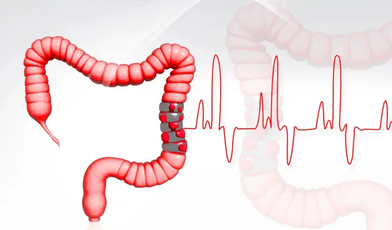 Depositphotos_4537086_L